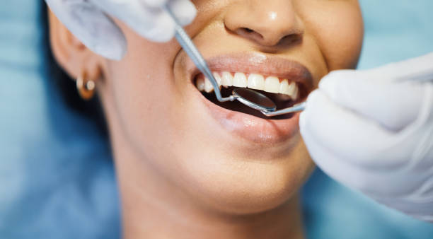 Best After-Hours Dental Trauma Care in Jordan, MN